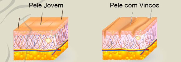 BOTOX-PELE
